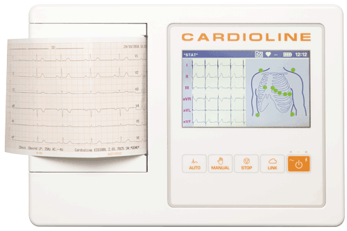 Ruhe EKG ECG100L mit Glasgow EKG Interpretation 